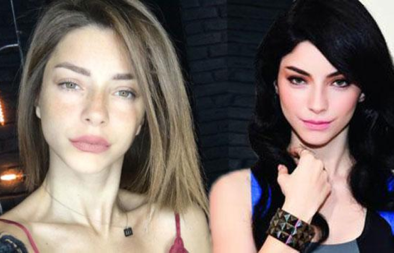 Merve Boluğur estetik mi yaptırdı?