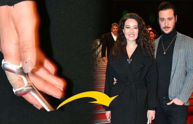 Pelin Akil'in parmağına dikiş atıldı