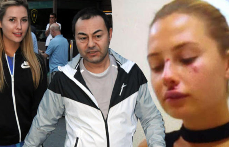 Serdar Ortaç'ın eşi Chloe kaza geçirdi. Serdar Ortaç: Instagram hayatımızı mahvetti!