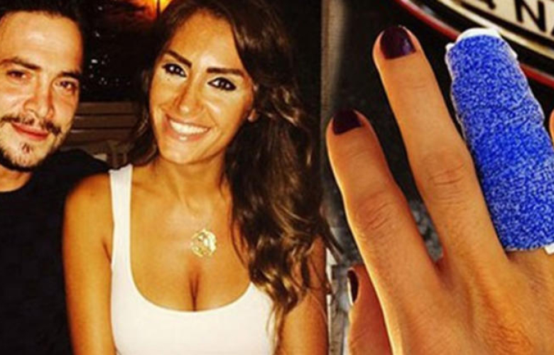 "Beni o adamla yanyana yazmayın" diyen eski sevgili, bugün televizyonda yaşadıklarını anlattı! İşte Ahmet Kural'ın parmak kırma hikayesi!