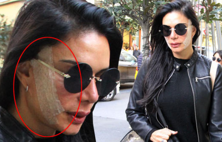 Kim Kardashian’a benzemek için ameliyat oldu. Kendisini göstermek için Nişantaşı'nda yürüyüşe çıktı!