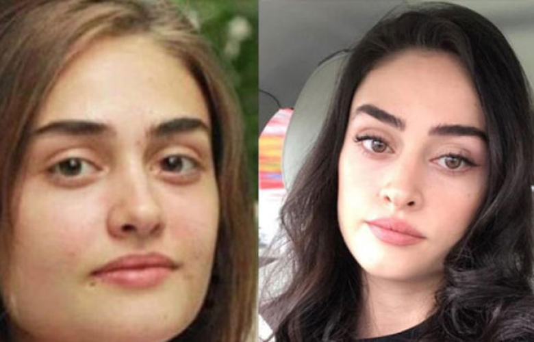 Esra Bilgiç: "Estetiğe zerre kadar ihtiyacım yok!"