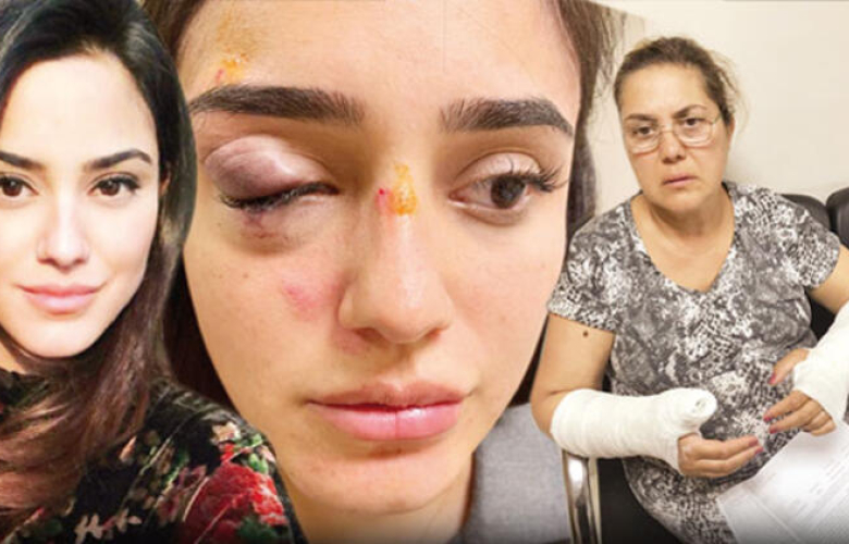 Sevgilisi ünlü manken Ceren Kaplakarslan ve annesine dehşeti yaşattı! Kan donduran detaylar....