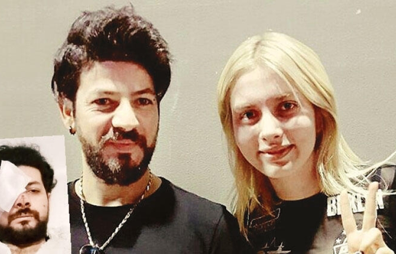 Son dakika... Genç müzisyen Şahan Dinç maganda kurşunuyla kör oldu!