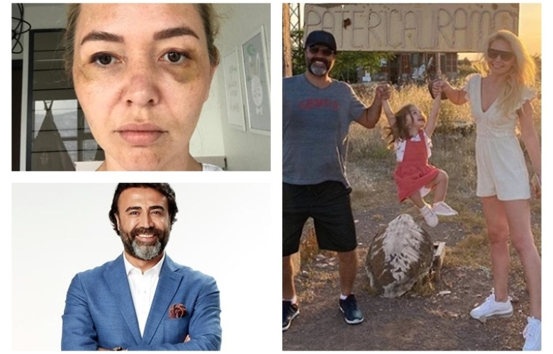 10 yıllık sevgilisini dövdüğü iddia edilen o doktor açıklama yaptı! İşte Nihat Dik'in açıklaması: "İftira!"