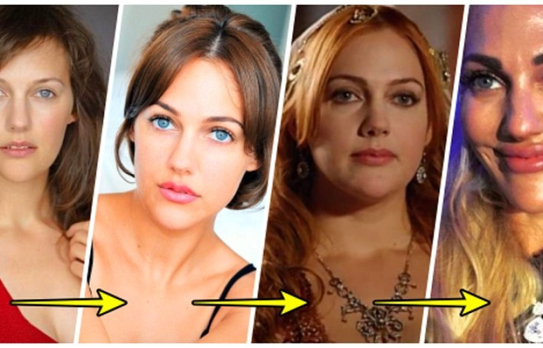 Meryem Uzerli'ye estetik yasağı! 