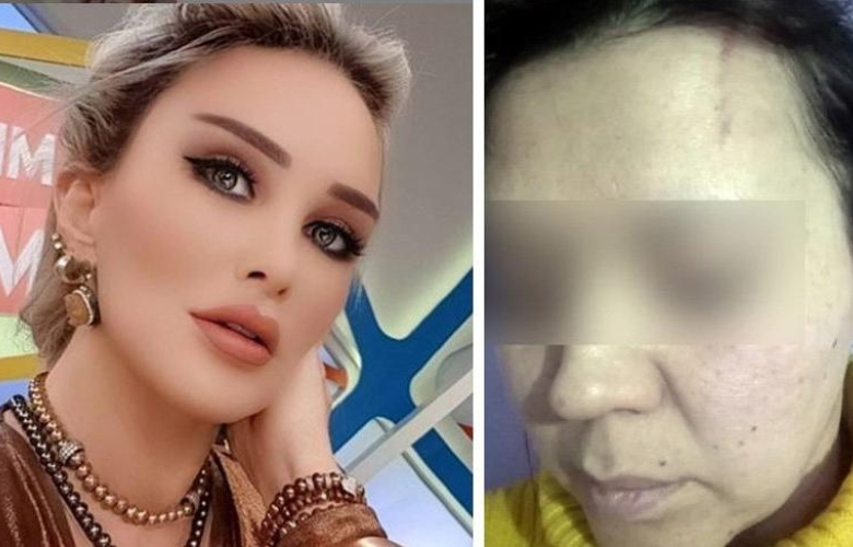 Seren Serengil darp iddiları için açıklama yaptı